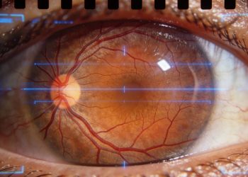 O exame de vista revolucionário que consegue prever problemas cardíacos usando IAs extremamente inteligentes