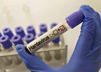 Vírus que pode causar a próxima pandemia está no Brasil, aponta estudo